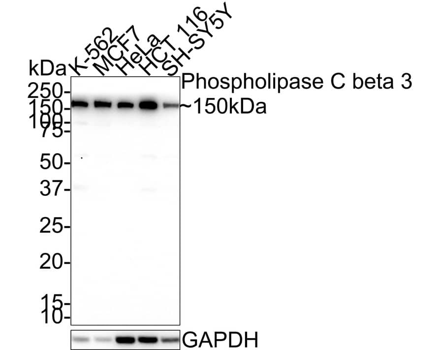 PLC-beta 3 Antibody (JE39-14)