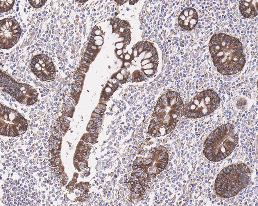 PLC-beta 3 Antibody (JE39-14)