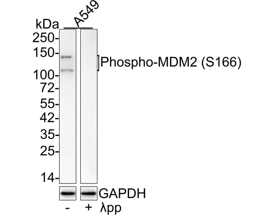 MDM2/HDM2 [p Ser166] Antibody (JE64-20)