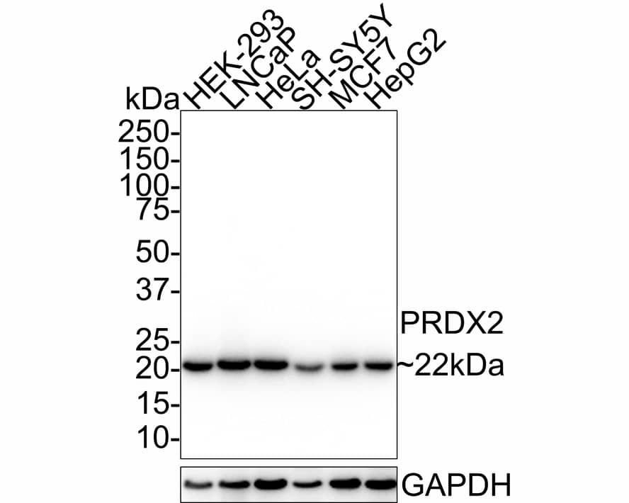 Peroxiredoxin 2 Antibody (7F2-R)