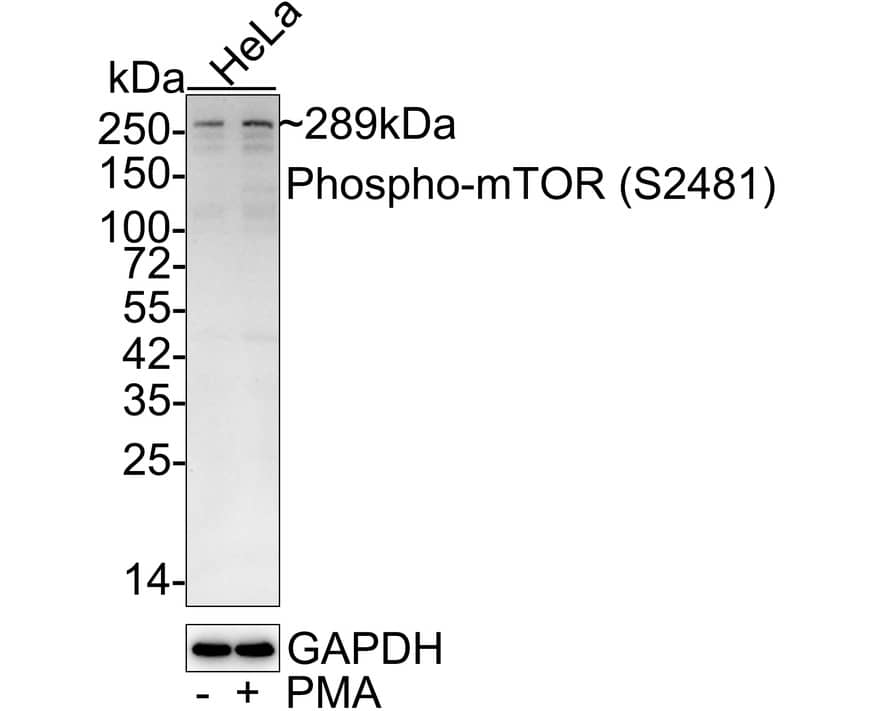 TOR/mTOR [p Ser2481] Antibody (JE59-62)