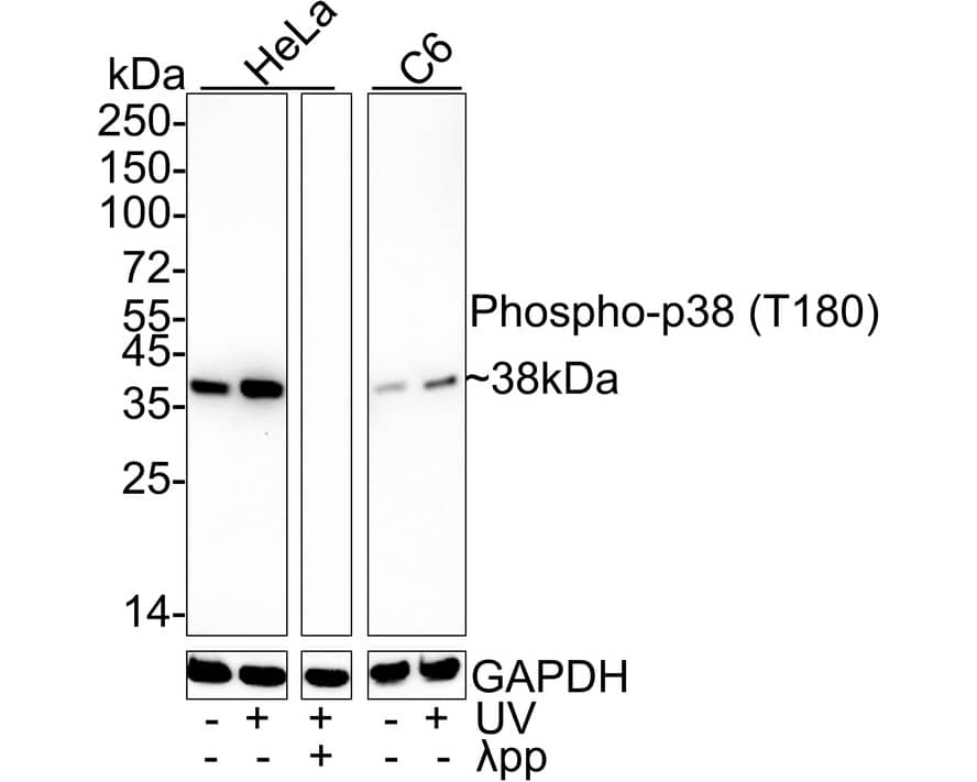 p38 alpha [p Thr180] Antibody (JE77-37)