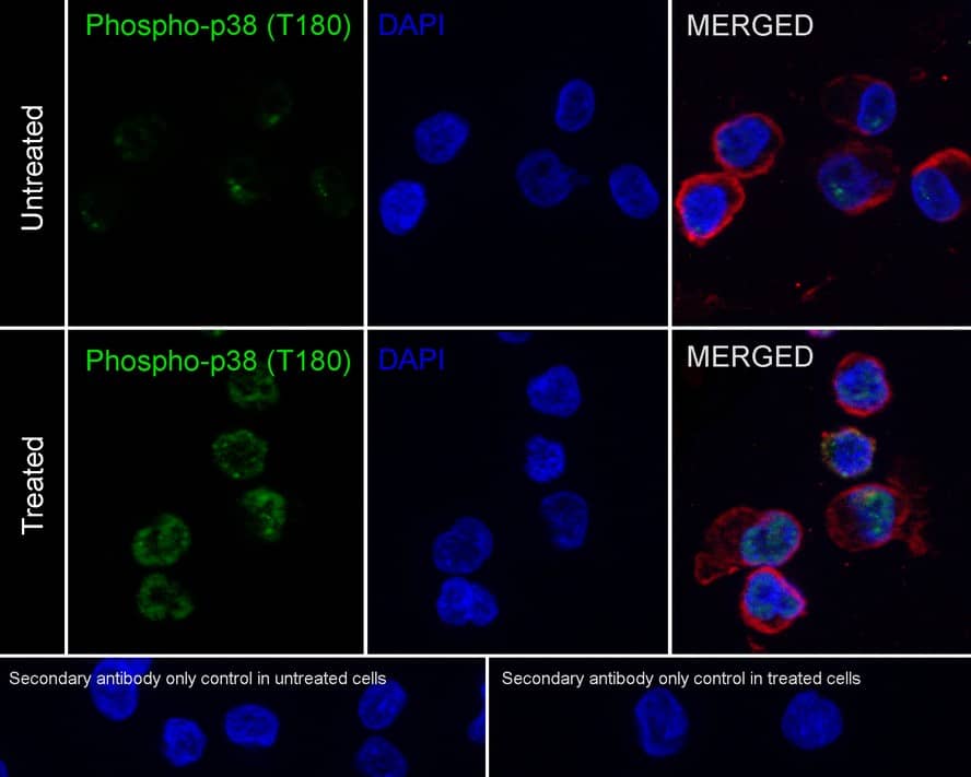 p38 alpha [p Thr180] Antibody (JE77-37)