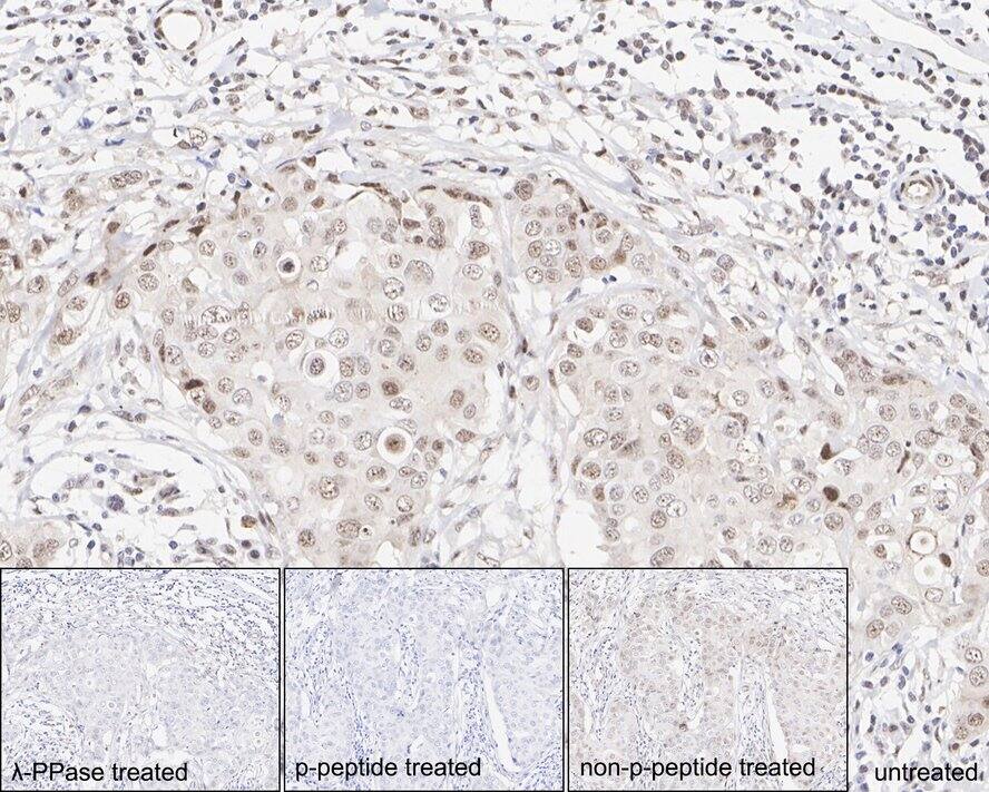 p38 alpha [p Thr180] Antibody (JE77-37)