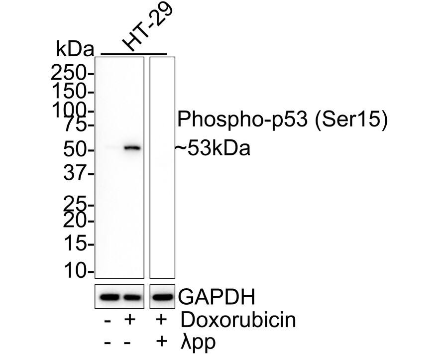 p53 [p Ser15] Antibody (PSH01-98) Western Blot: p53 [p Ser15] Antibody (PSH01-98) [NBP3-32782]