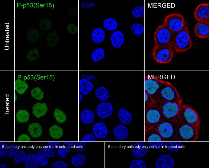 p53 [p Ser15] Antibody (PSH01-98)
