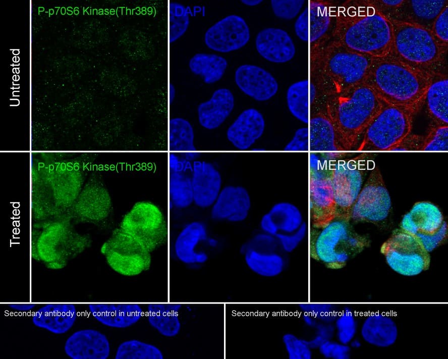p70 S6 Kinase/S6K [p Thr389] Antibody (PSH02-23)