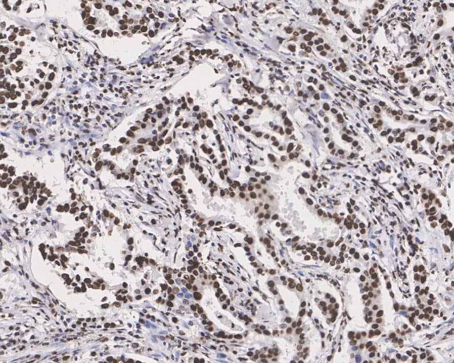 p70 S6 Kinase/S6K [p Thr389] Antibody (PSH02-23)