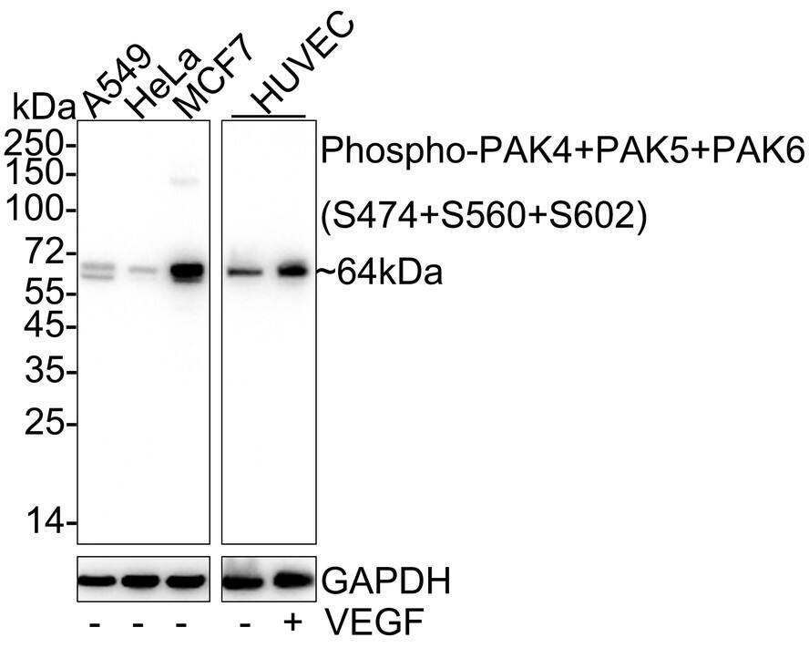 PAK4+5+6 [p Ser602, p Ser474, p Ser560] Antibody (JE57-42)