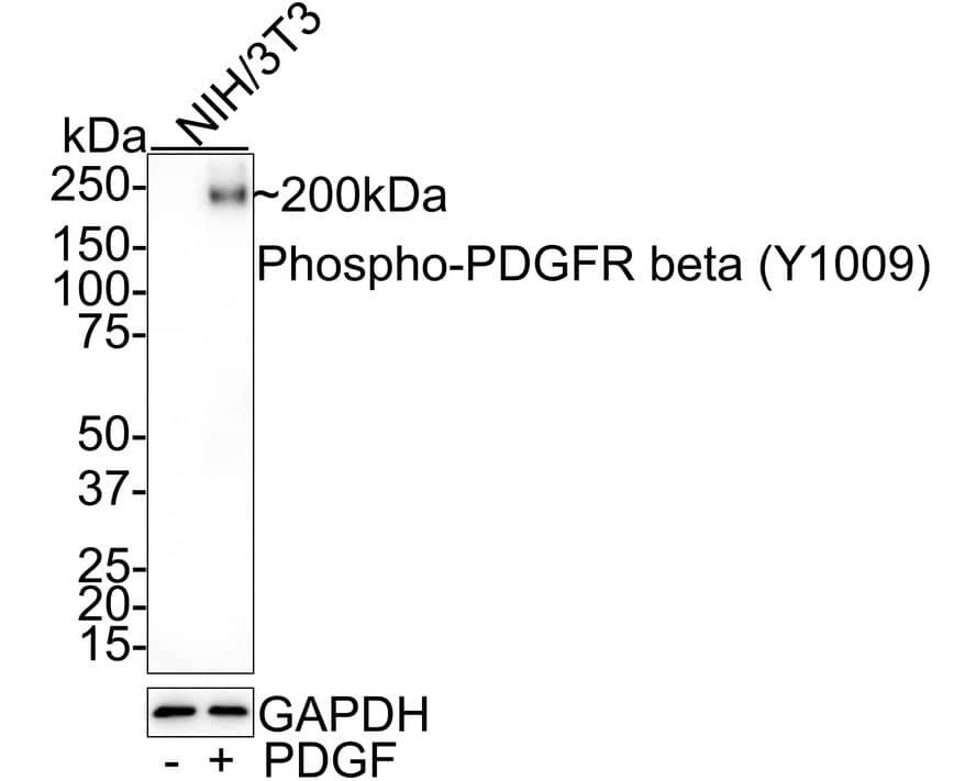 PDGF R beta [p Tyr1009] Antibody (JE46-72) Western Blot: PDGF R beta [p Tyr1009] Antibody (JE46-72) [NBP3-32785]