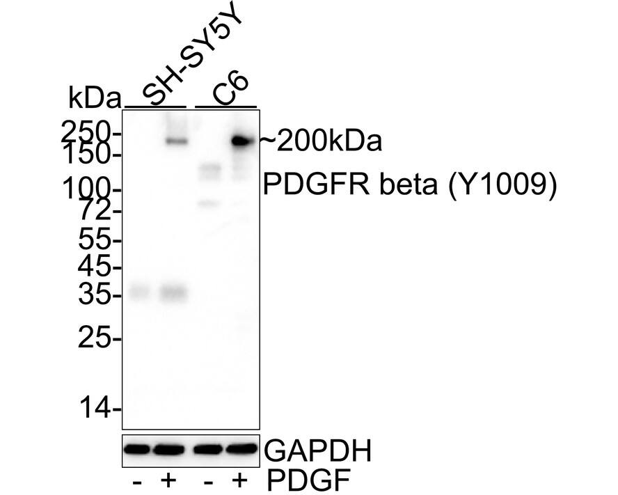 PDGF R beta [p Tyr1009] Antibody (JE46-72) Western Blot: PDGF R beta [p Tyr1009] Antibody (JE46-72) [NBP3-32785]