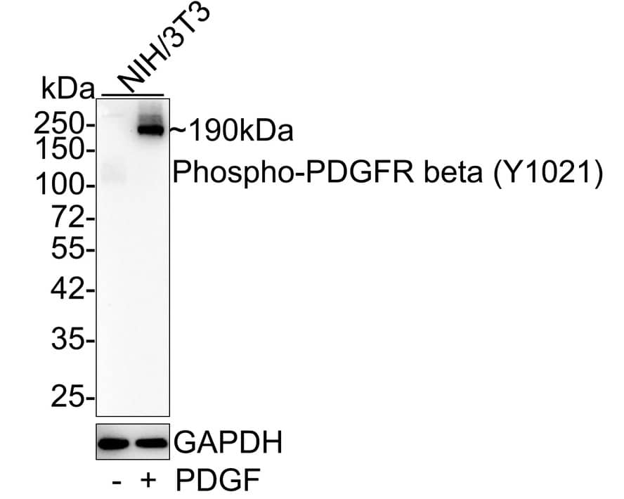 PDGF R beta [p Tyr1021] Antibody (JE48-54)