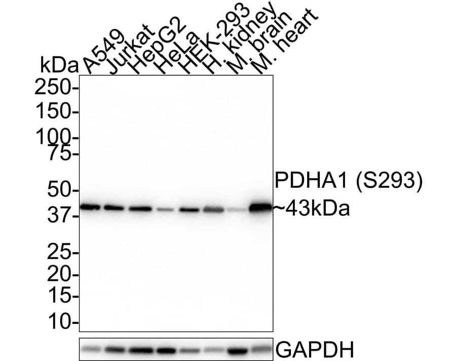 Pyruvate Dehydrogenase E1-alpha subunit [p Ser293] Antibody (JE58-27)