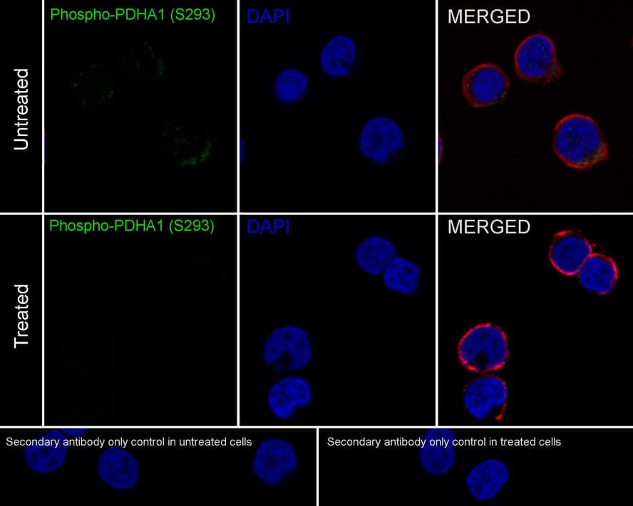 Pyruvate Dehydrogenase E1-alpha subunit [p Ser293] Antibody (JE58-27)