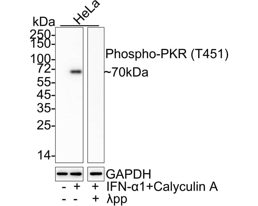 PKR [p Thr451] Antibody (JE46-70)