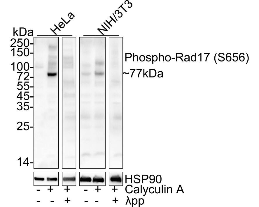 Rad17 [p Ser656] Antibody (JE63-30) Western Blot: Rad17 [p Ser656] Antibody (JE63-30) [NBP3-32792]
