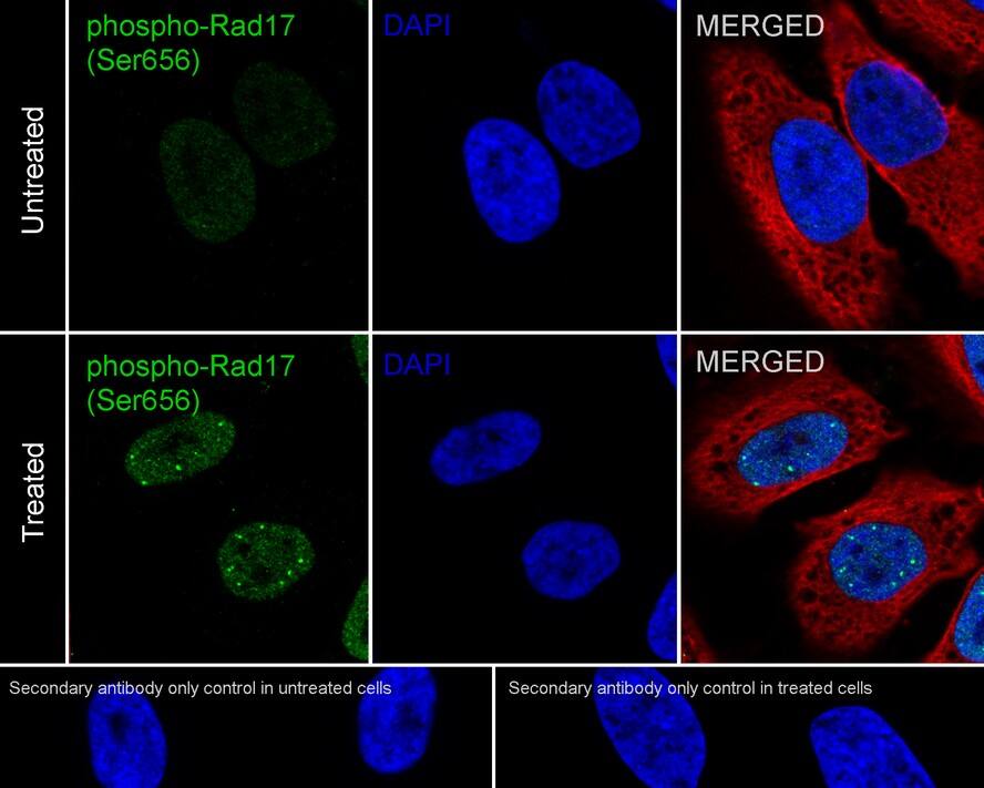 Rad17 [p Ser656] Antibody (JE63-30)