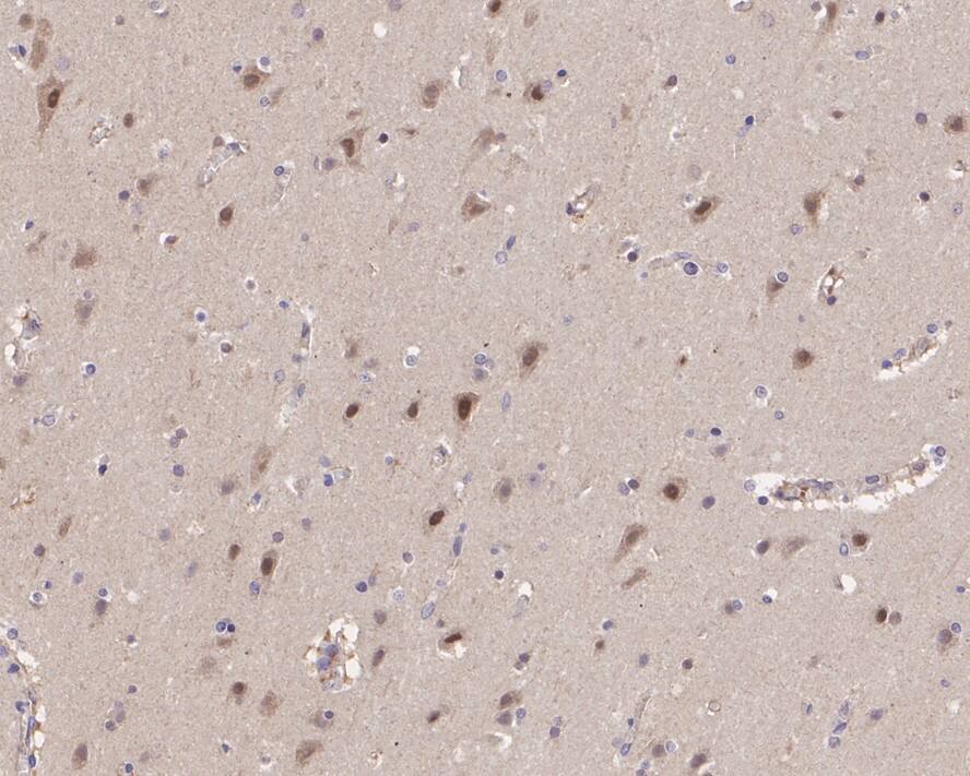 PSMD13 Antibody (PSH0-52)
