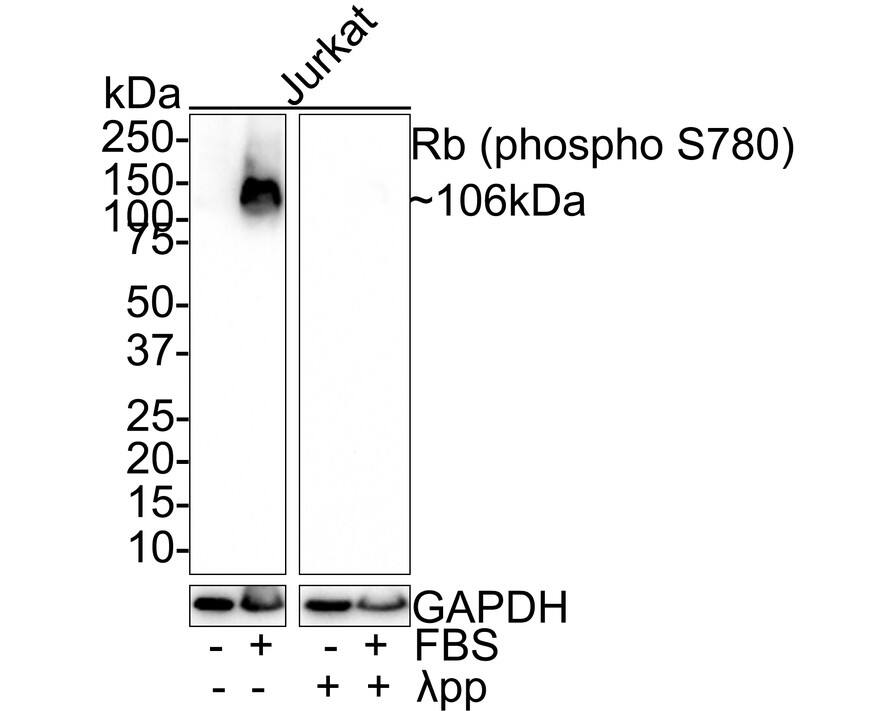 RB1 [p Ser780] Antibody (JE44-61)