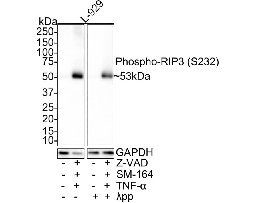 RIPK3/RIP3 [p Ser232] Antibody (JE44-62)