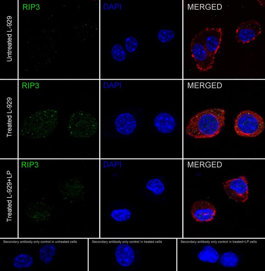 RIPK3/RIP3 [p Ser232] Antibody (JE44-62)