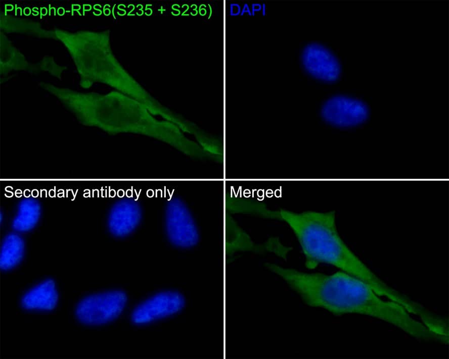 Ribosomal Protein S6/RPS6 [p Ser235, p Ser236] Antibody (PS01-04)