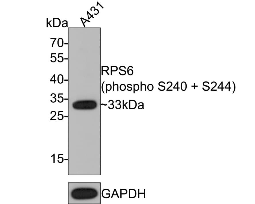 Ribosomal Protein S6/RPS6 [p Ser240, p Ser244] Antibody (PS00-65)