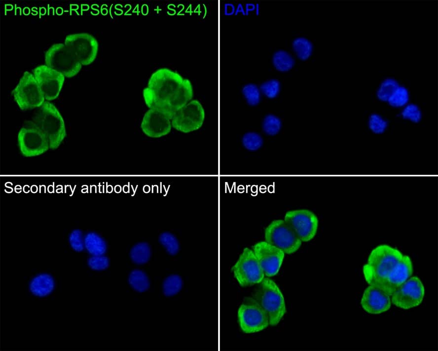 Ribosomal Protein S6/RPS6 [p Ser240, p Ser244] Antibody (PS00-65)