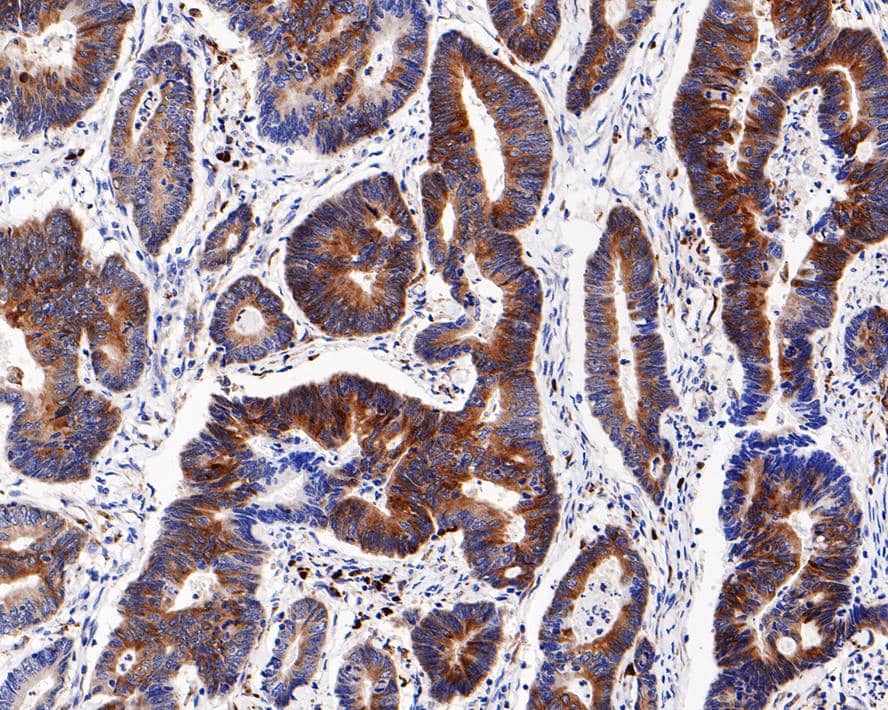 Ribosomal Protein S6/RPS6 [p Ser240, p Ser244] Antibody (PS00-65)