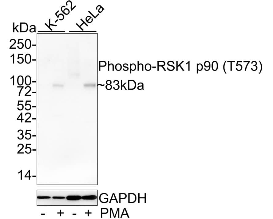 RSK1 [p Thr573] Antibody (JE50-12)