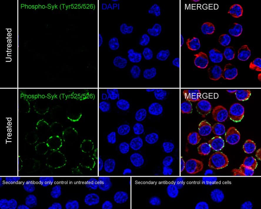 SYK [p Tyr526, p Tyr525] Antibody (PSH03-70)