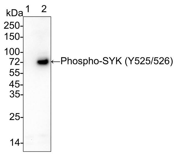 SYK [p Tyr526, p Tyr525] Antibody (PSH03-70)