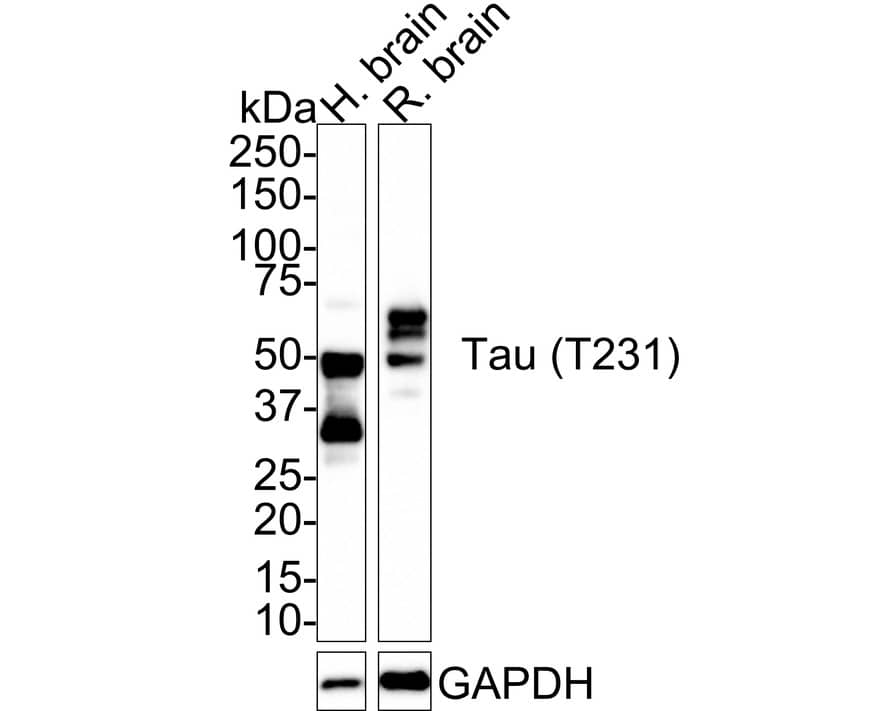 Tau [p Thr231] Antibody (PSH01-05)