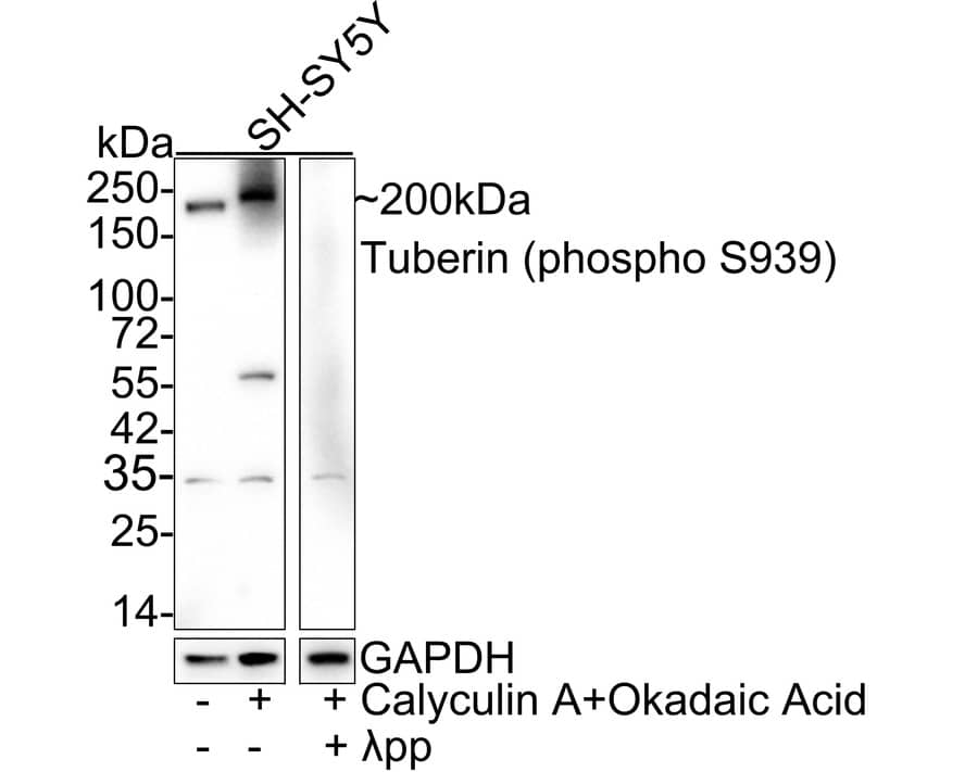 TSC2 [p Ser939] Antibody (JE54-06)