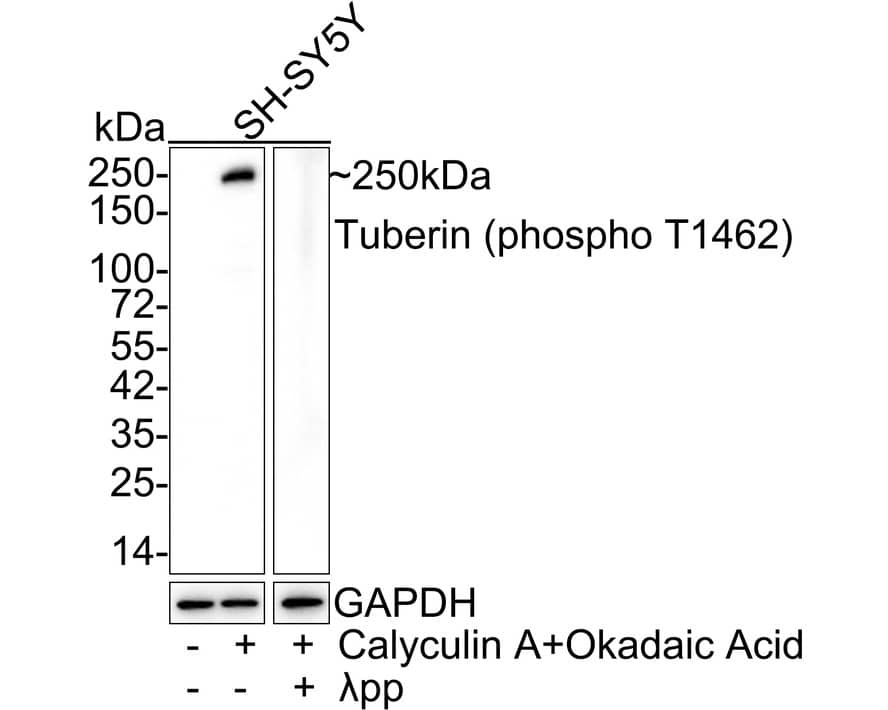 TSC2 [p Thr1462] Antibody (JE43-81)