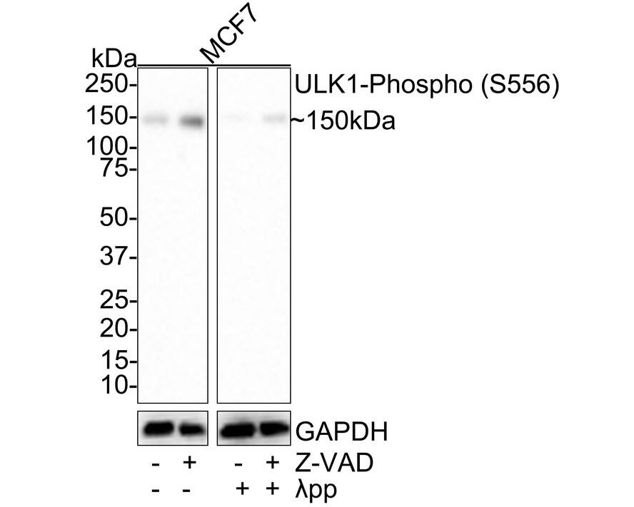 ULK1 [p Ser556] Antibody (JE59-28)