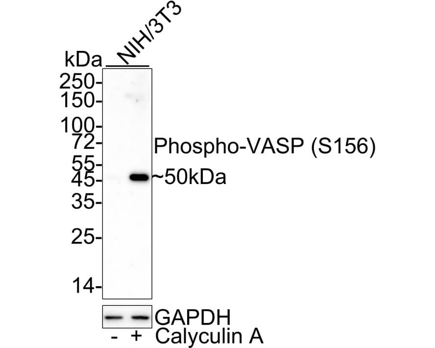 VASP [p Ser156] Antibody (JE45-91) Western Blot: VASP [p Ser156] Antibody (JE45-91) [NBP3-32815]