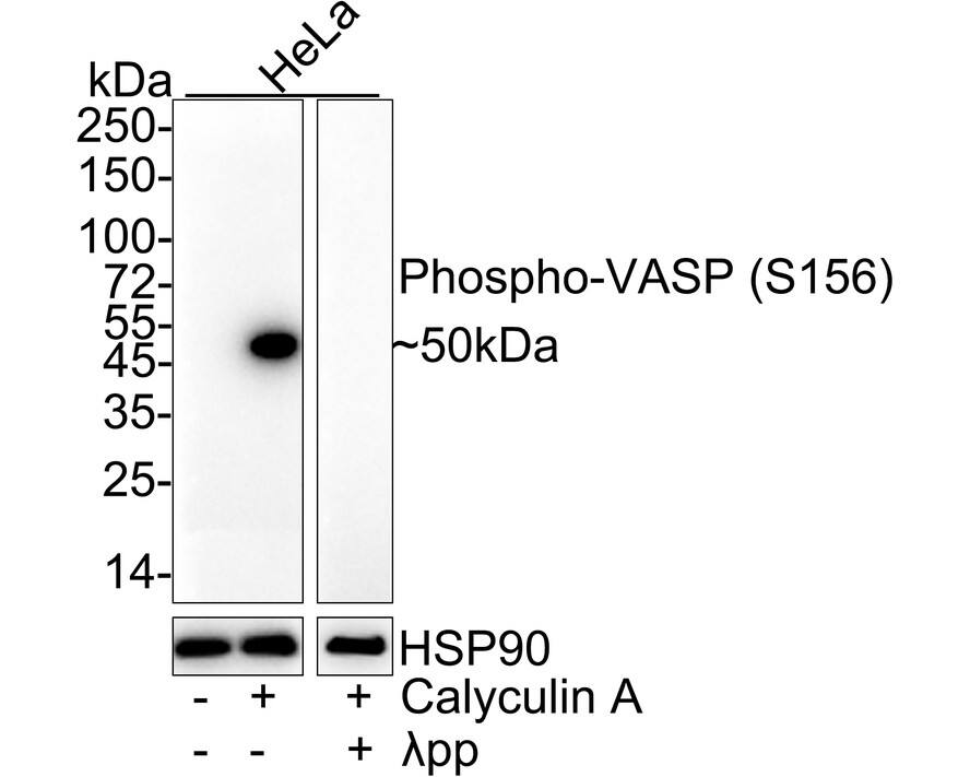 VASP [p Ser156] Antibody (JE45-91)