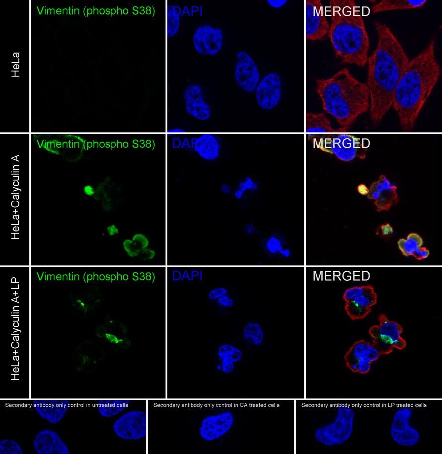 Vimentin [p Ser38] Antibody (JE43-26)