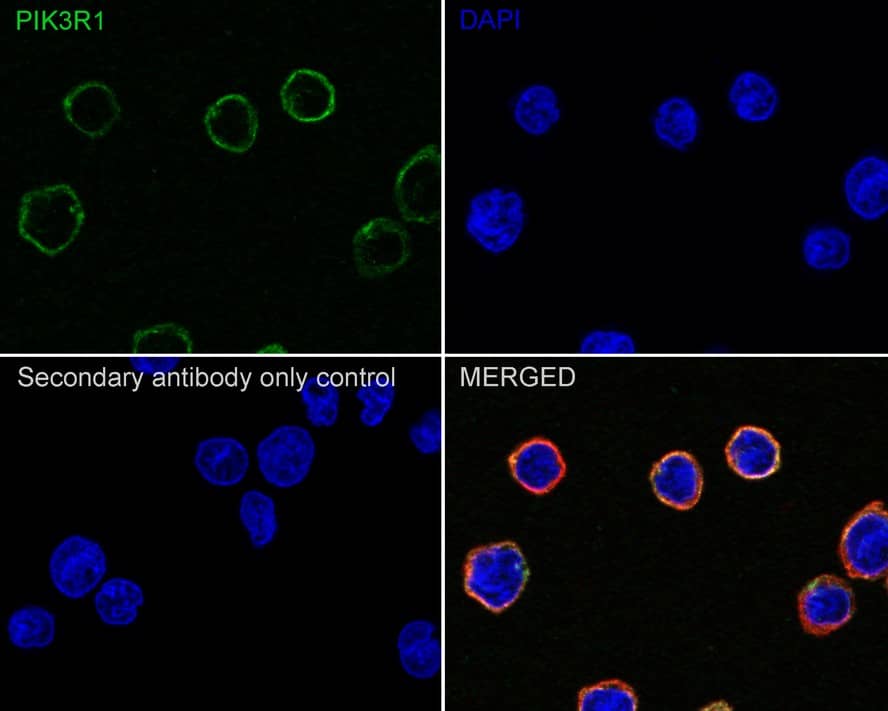 PI 3-Kinase p85 alpha Antibody (A3-D0-R)