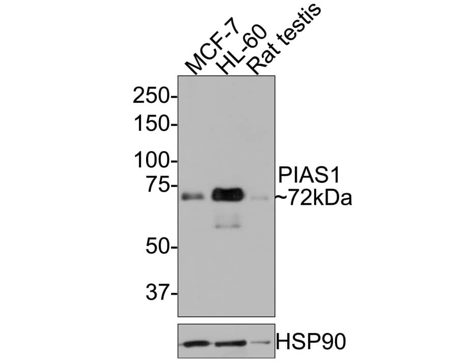 PIAS3 Antibody (JE30-36)