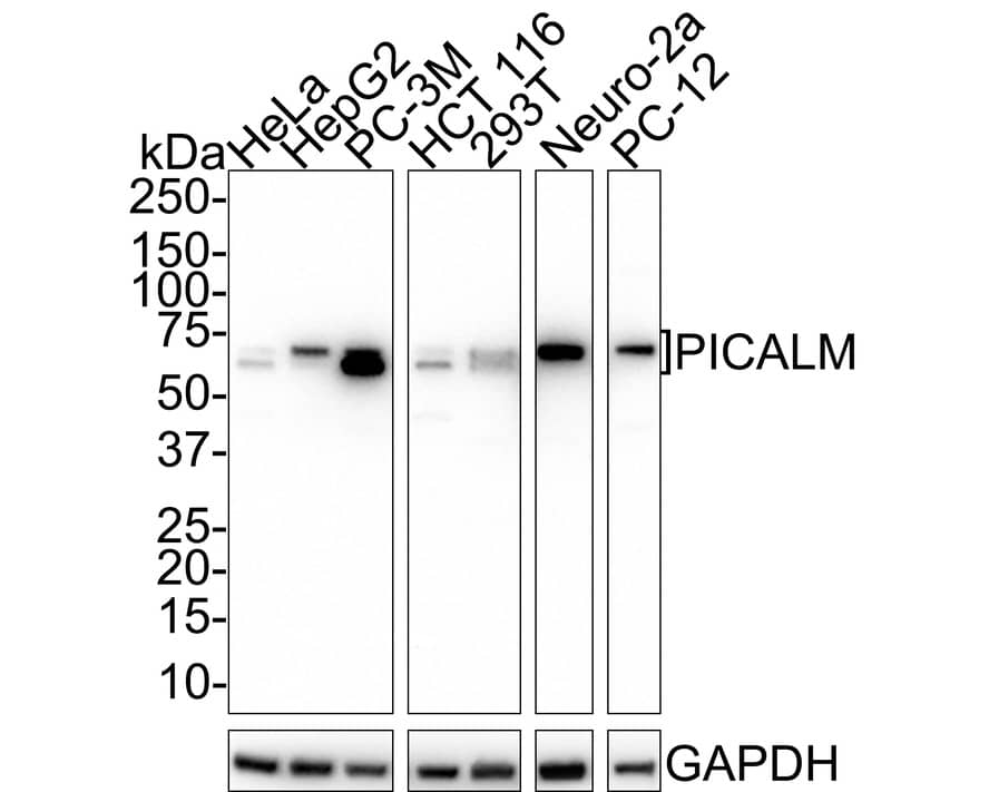 PICALM Antibody (PSH01-64)