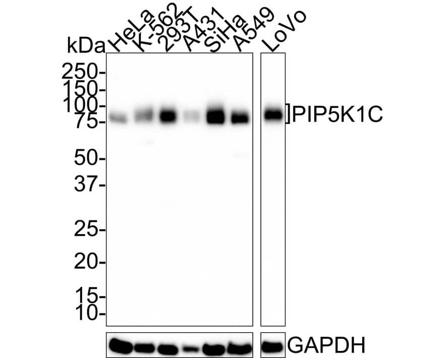 PIP5K1C Antibody (PSH01-43)