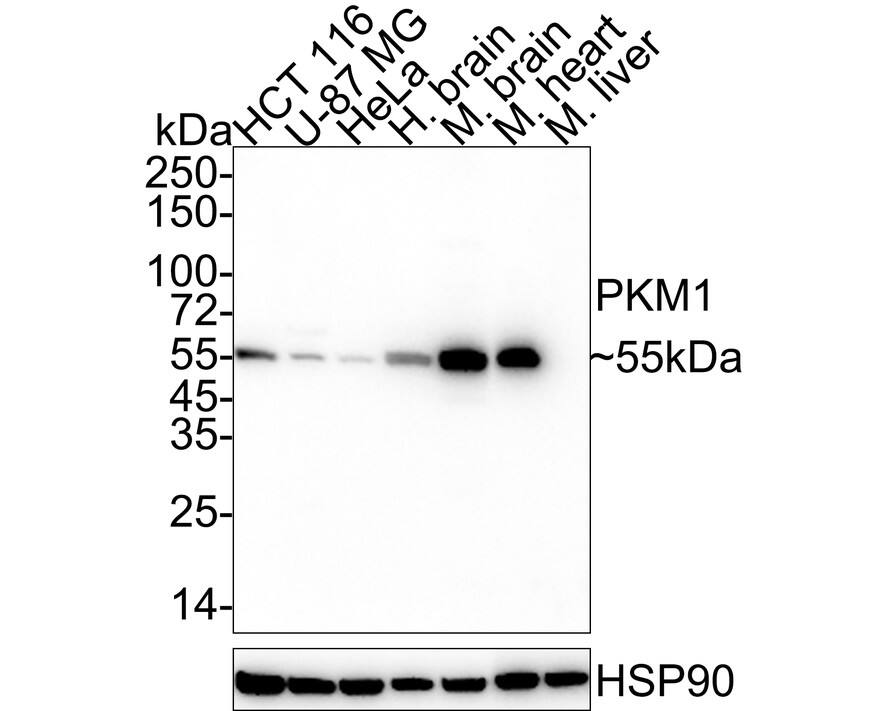 PKM1 Antibody (PSH04-37)