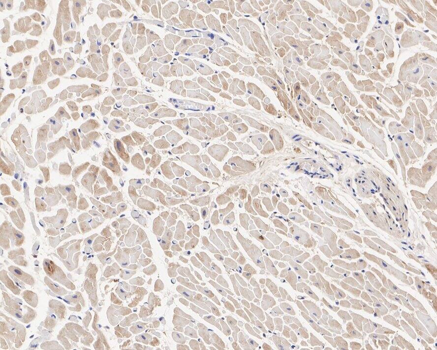 PKM1 Antibody (PSH04-37)