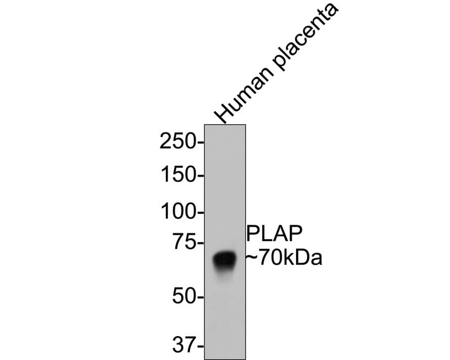 Alkaline Phosphatase/ALPP Antibody (PD00-19)