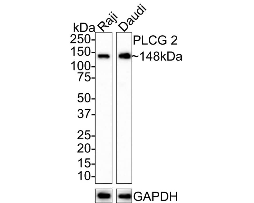 PLC-gamma 2 Antibody (JE39-12)