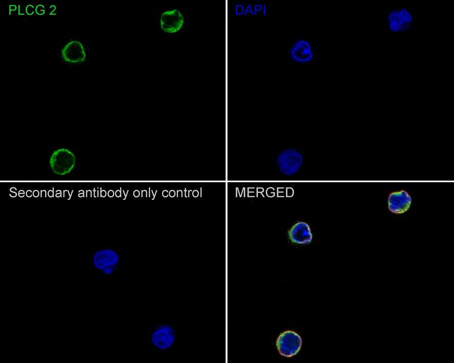PLC-gamma 2 Antibody (JE39-12)