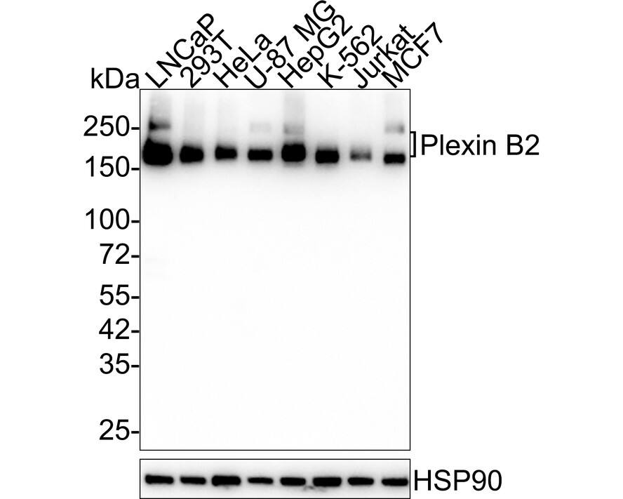 Plexin B2 Antibody (PSH03-48) Western Blot: Plexin B2 Antibody (PSH03-48) [NBP3-32828]