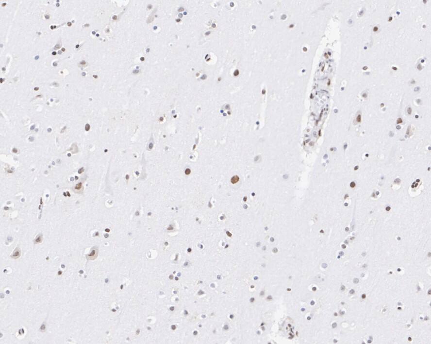 PML Protein Antibody (PSH02-68)